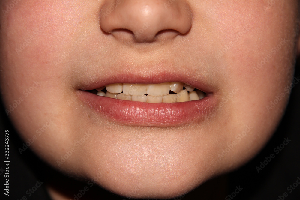Naklejka premium Boy's smile macro photography. Baby's teeth. The lower part of the face