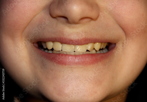 Boy's smile macro photography. Baby's teeth. The lower part of the face