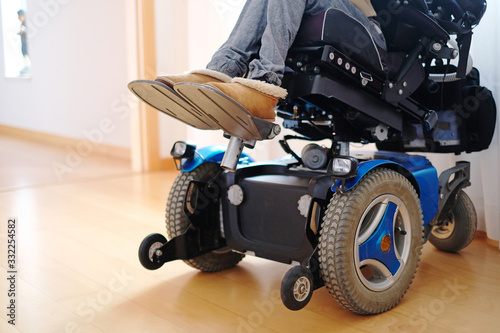 A disabled woman sitting in a blue electric wheelchair indoors