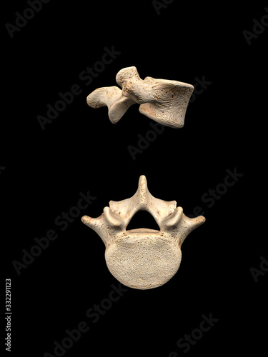 Lumbar L5 Vertebra Top and Side Views on Black Background photo