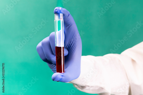 A close-up of a test tube with a blood sample. Corona. Coronavirus test.