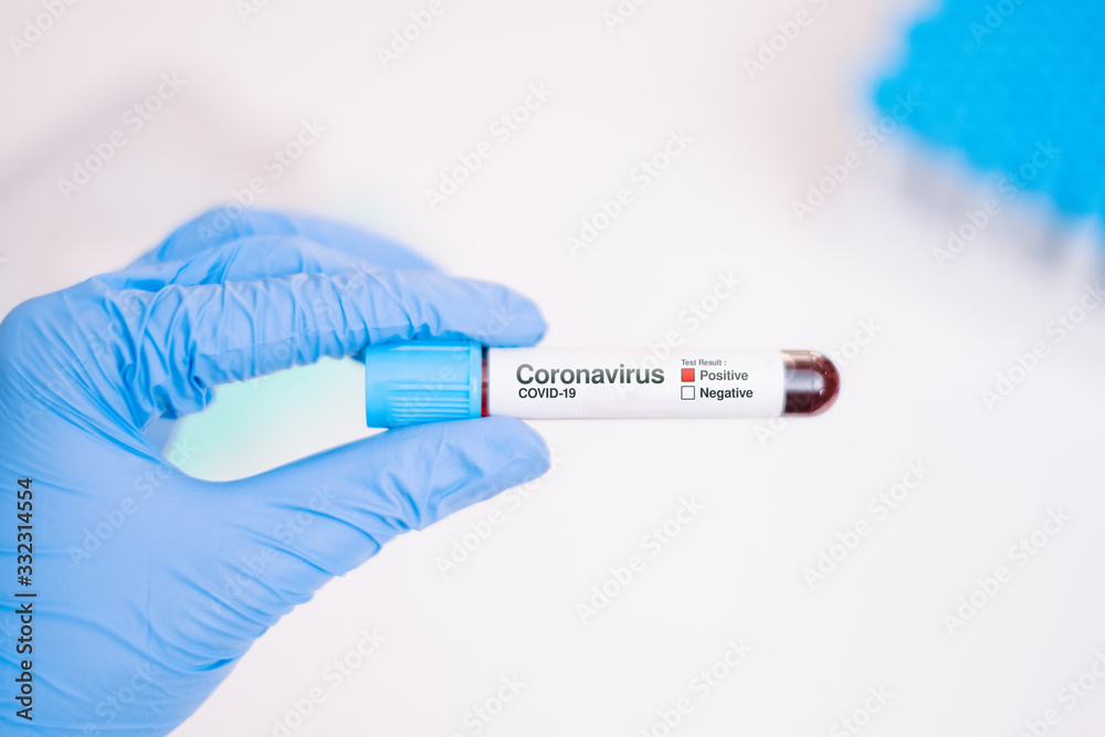 Obraz premium Nurse wearing disposable coverall with mask and safety google holding a positive blood test result .Pandemic 2019 Coronavirus 2019-nCoV. 