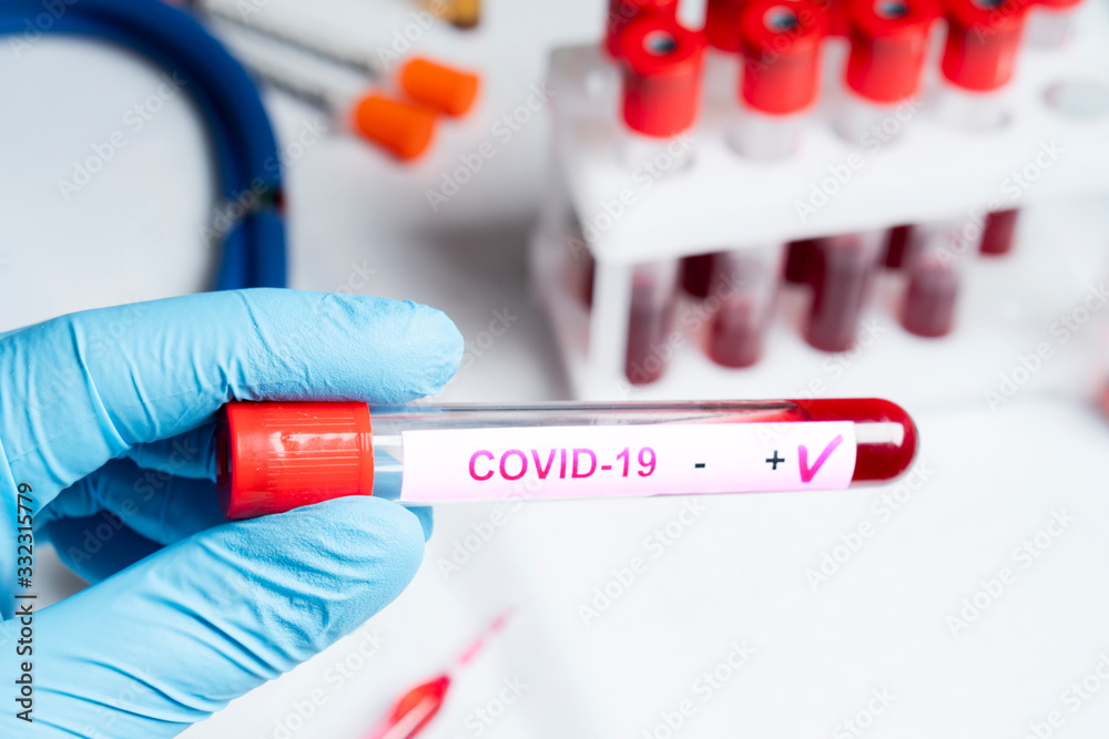 Positive coronavirus blood test concept. Analyzing blood sample in test tube for coronavirus test in doctor hand. Tube with blood for 2019-nCoV or COVID-19 test. Coronavirus blood analysis concept.
