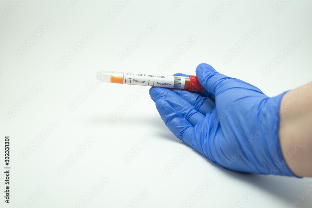 Obraz premium Hand holding a blood test. The blood test is from Coronavirus, 2019-NcOv. Tests positive for coronavirus. The glove is blue and the background is white.