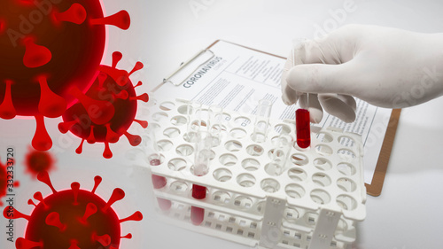 Coronavirus 2019-ncov Blood Sample. Corona virus outbreaking. photo