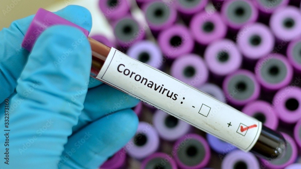 Obraz premium coronavirus