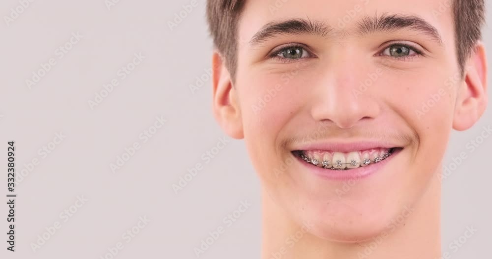 Smiling young man with braces on his teeth. Handsome young boy with ...