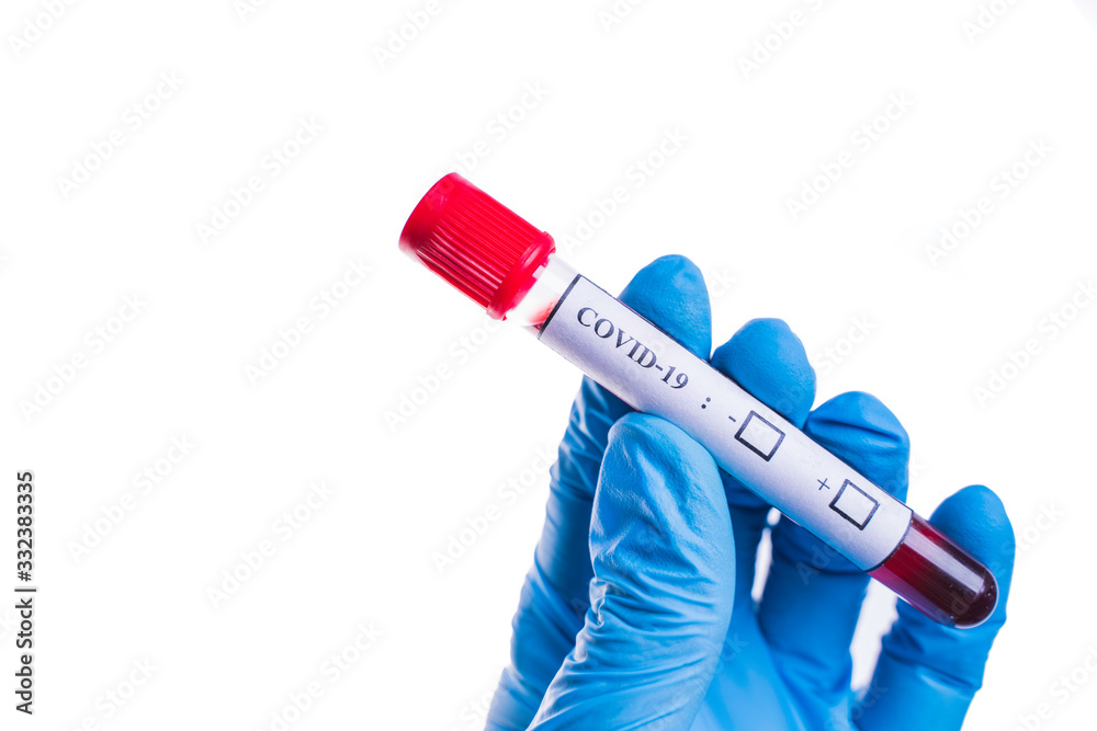 Obraz premium blood sample tube Coronavirus,Covid-19 In the hand, Putts wore blue protective gloves.Isolated on white background