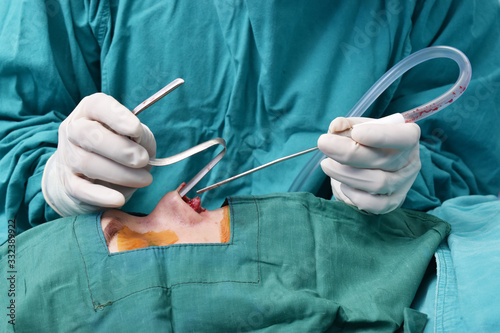 The doctor is sewing the rhinoplasty in the operating room.  A doctor using a nose device And use disposable blood sucking tools