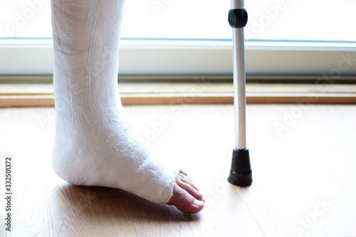 A man with a cane with a broken leg in a cast.