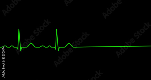 Ekg line. Heart stops beating. Death.