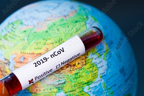 Positive blood test result for the new rapidly spreading Coronavirus, originating in Wuhan, China Coronavirus 2019-nCoV Blood Sample. Corona virus outbreaking. Epidemic virus Respiratory Syndrome.