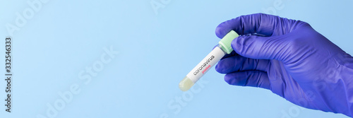 test tube in hand of lab technician with sample of coronavirus covid-19, deadly global pandemic concept