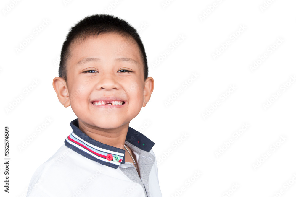 Asian kid with tooth decay and smiling, isolated background. Asian kid with tooth decay and smiling, isolated background.