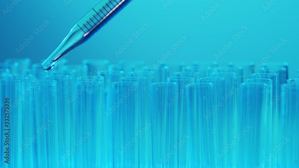 Close-up of scientific laboratory in hospital. Epidemic disease, healthcare, vaccine research and coronavirus 2019-ncov test. Close-up of scientific laboratory in hospital. Epidemic disease, healthcare, vaccine research and coronavirus 2019-ncov test.