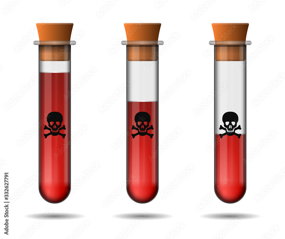 Glass tube, blood sample test coronavirus Glass tube, blood sample test coronavirus