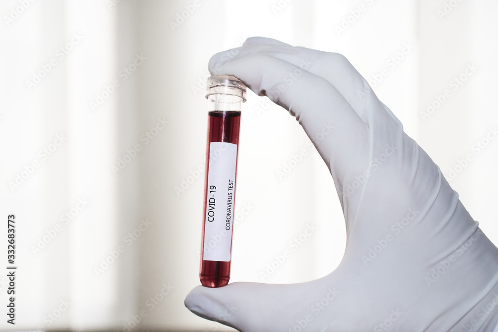 Positive COVID-19 test and laboratory sample of blood testing for diagnosis new Corona virus infection(novel corona virus disease 2019 from Wuhan with hospital background. Pandemic infectious concept Positive COVID-19 test and laboratory sample of blood testing for diagnosis new Corona virus infection(novel corona virus disease 2019 from Wuhan with hospital background. Pandemic infectious concept