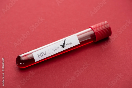 Картината върху платно negative hiv blood sample test on red background