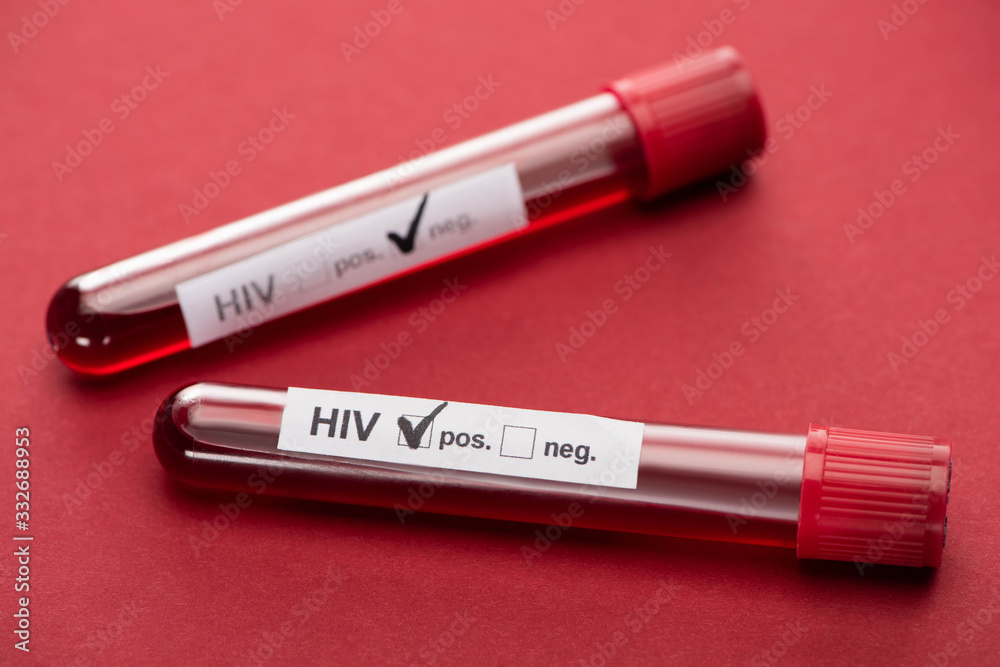selective focus of negative and positive hiv blood sample test on red background selective focus of negative and positive hiv blood sample test on red background