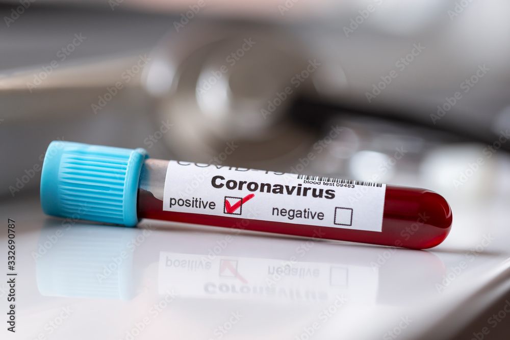 Obraz premium Blood sample for coronavirus testing