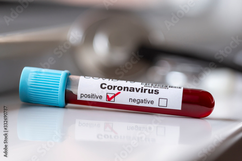Blood sample for coronavirus testing