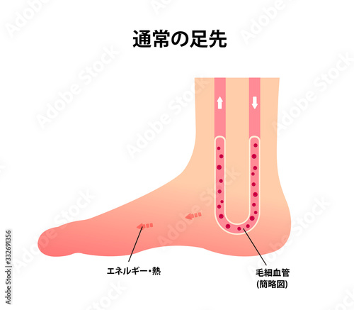 通常の足 イラスト (冷え性の原因)