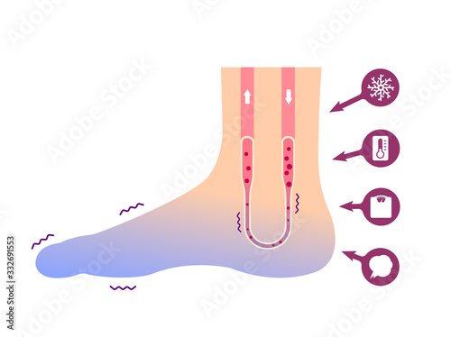 Cold foot blood circulation illustration (sensitivity to cold, cold toes) / No text