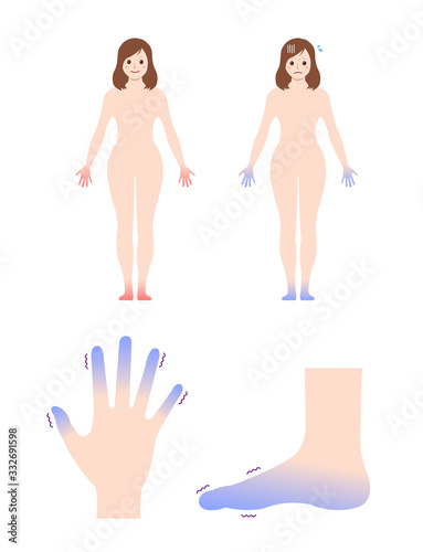 Cold woman's body, hand and foot set / blood circulation illustration (sensitivity to cold )
