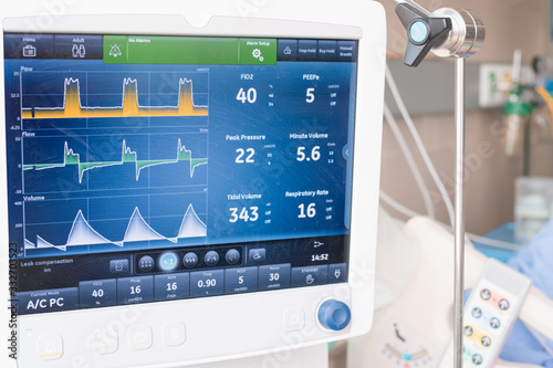 Ventilator monitor ,given oxygen by intubation tube to patient, setting in ICU/Emergency room