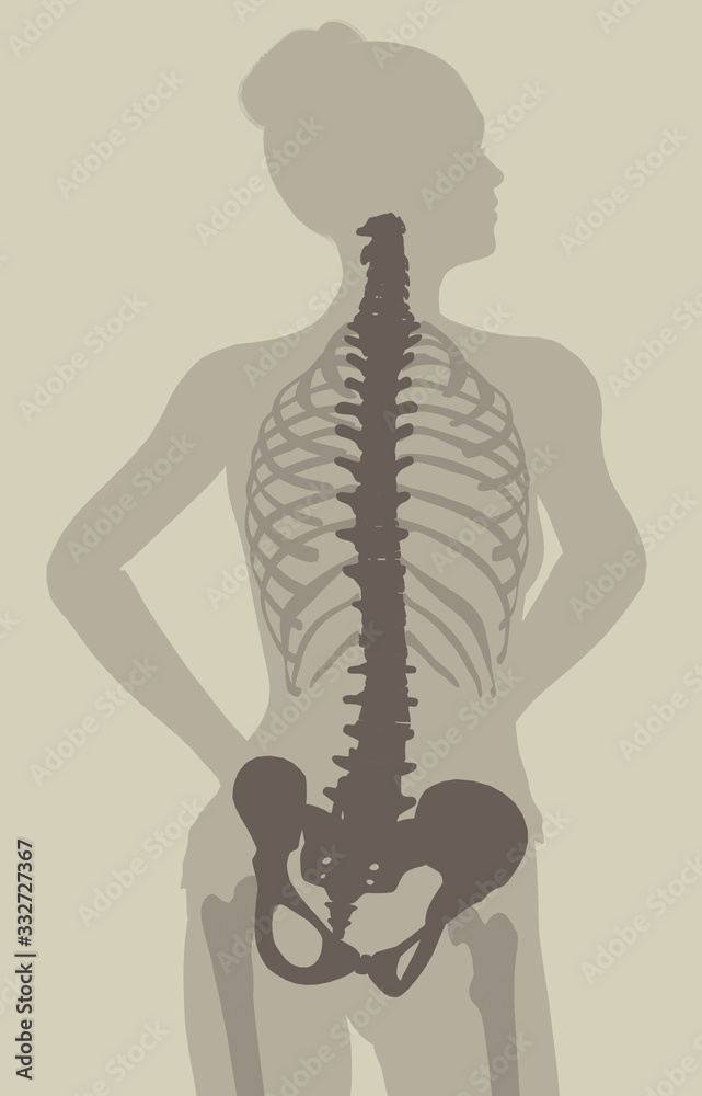 Fototapeta premium Backache pain, spine in back view, 3D medically illustration