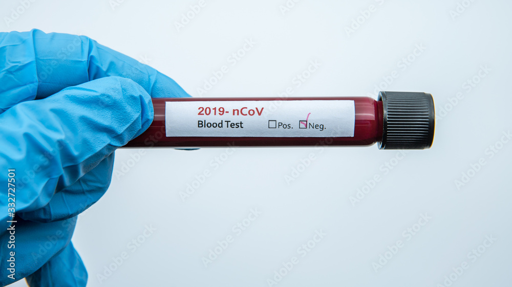 Obraz premium Surgical gloves with a negative coronavirus blood sample test.