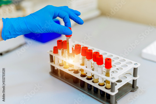 Blood samples for research in microtubes. Pneumonia diagnosting. COVID-19 and coronavirus identification. Pandemia. Centrifuge with screen. photo