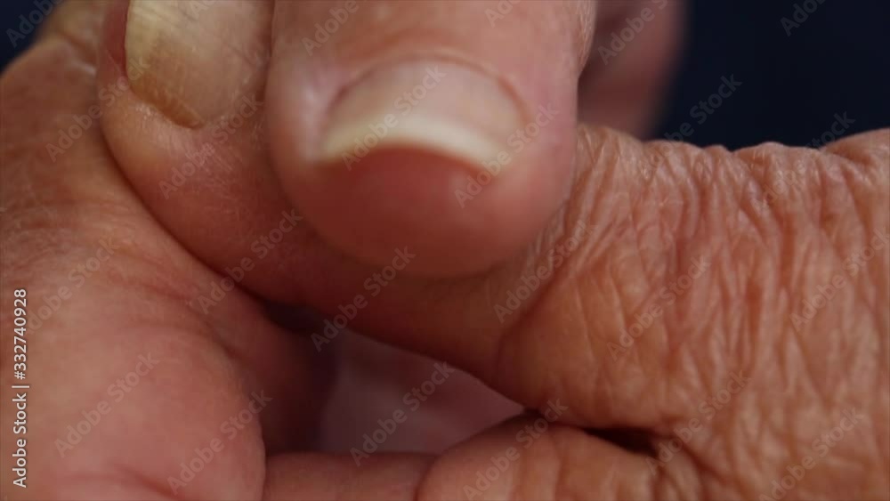Closeup of Elderly Hands Closeup of Elderly Hands