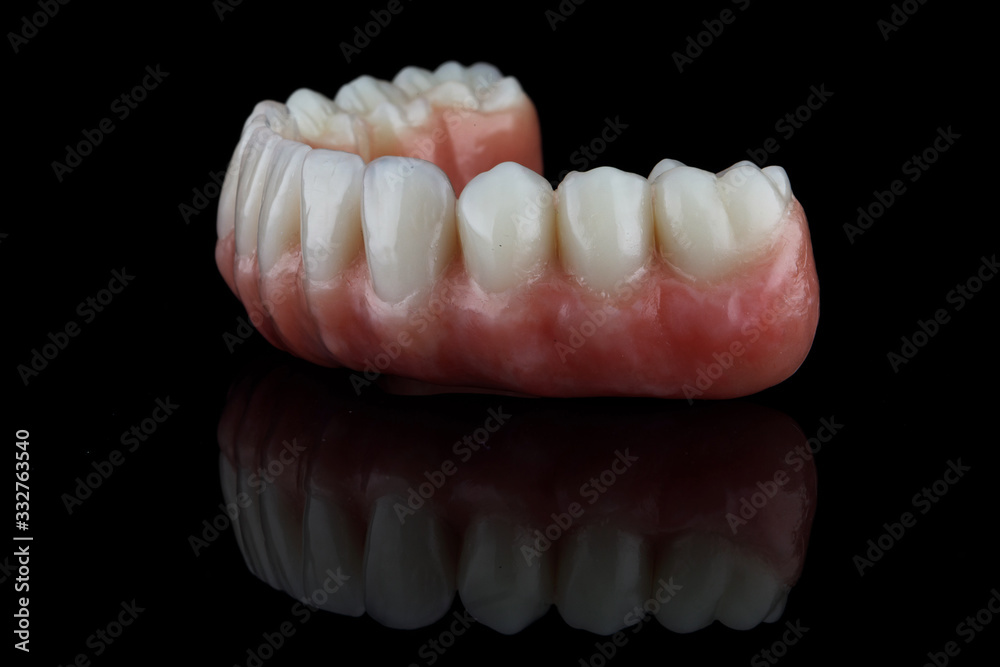 dental lower jaw prosthesis with pink gum on black glass, side view dental lower jaw prosthesis with pink gum on black glass, side view