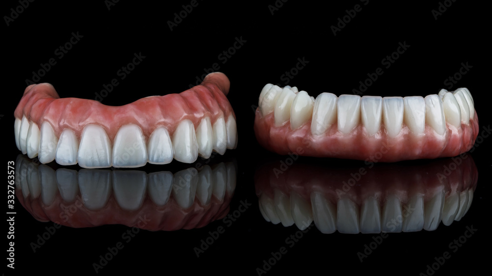 two dental prostheses of the lower and upper jaws on a black background with perfect reflection two dental prostheses of the lower and upper jaws on a black background with perfect reflection