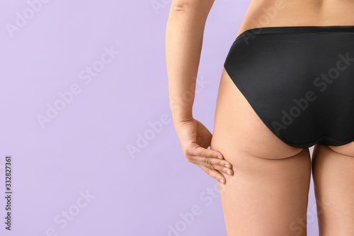 Young woman with cellulite problem on color background