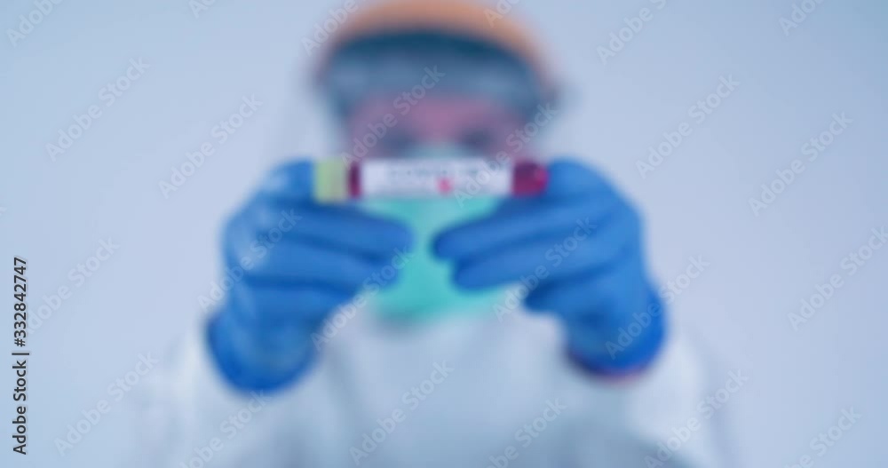 Medical lab worker with blue surgical gloves holding positive blood samples tube testing for coronavirus Covid-19 (2019-nCoV) shot in 4k super slow motion
