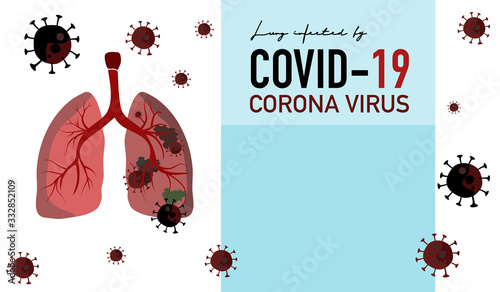 Lung infected coronavirus.Covid-19 destroyed lung isolated on white and blue background.Virus cells eating Human lung . Blue color Copyspace. 