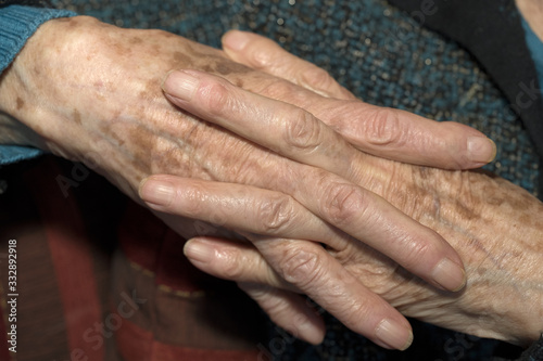 Mani di donna anziana con macchie della pelle
