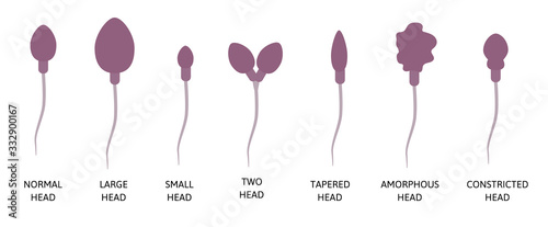 Spermogram and semen parameters, teratozoospermia, normal and abnormal sperm. Head defects spermatozoon.