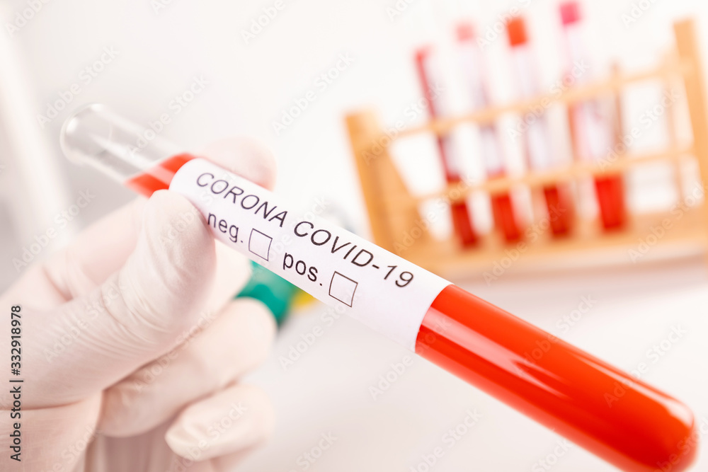 Fototapeta premium CORONA Virus