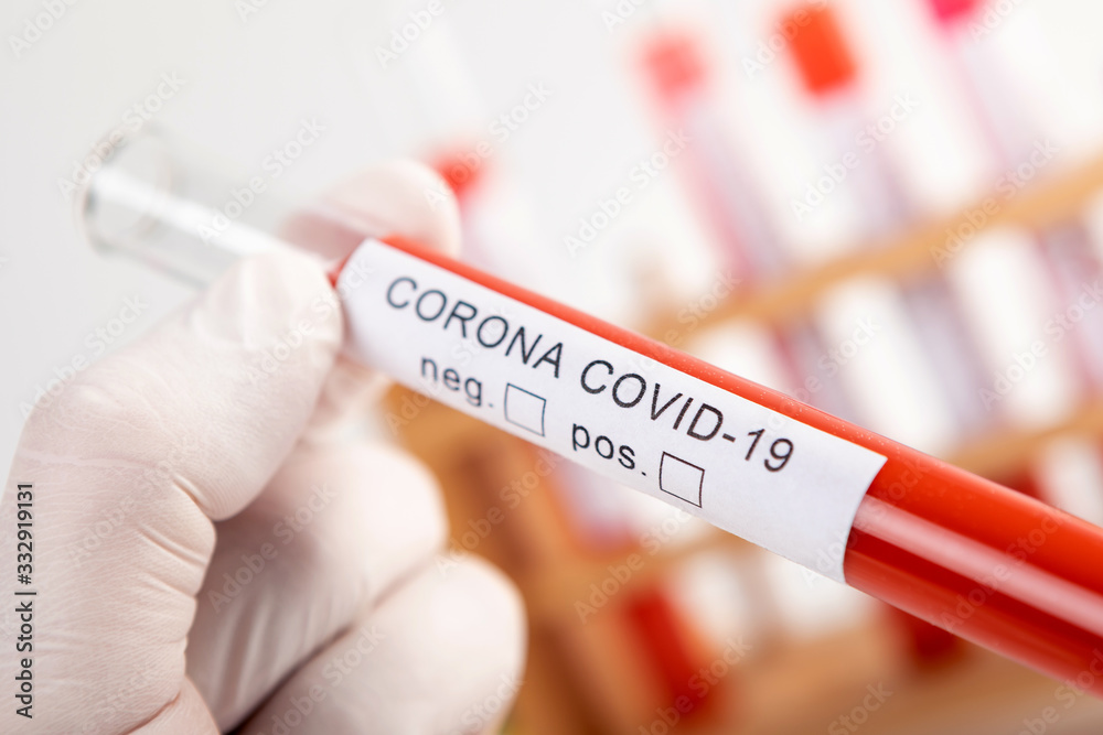 Fototapeta premium CORONA Virus