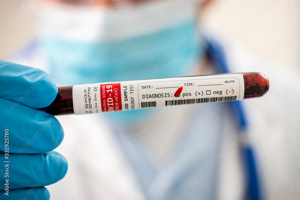 Fototapeta premium Doctor holding test tube blood sample