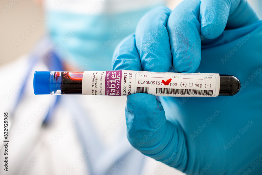 Naklejka premium Doctor holding test tube blood sample