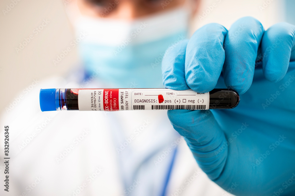 Doctor holding test tube blood sample Doctor holding test tube blood sample