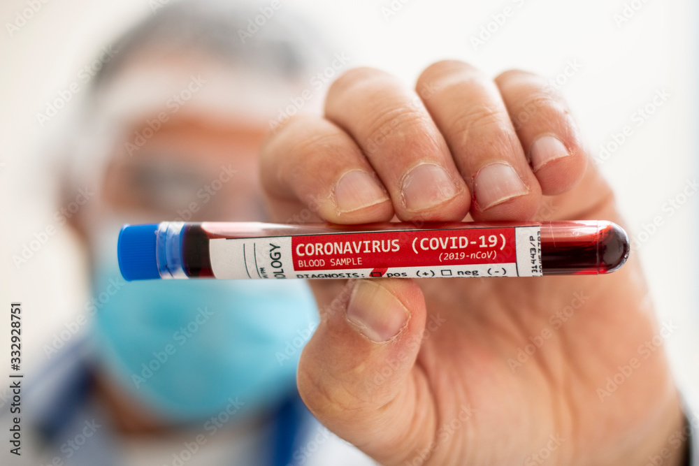 Fototapeta premium Doctor holding test tube blood sample
