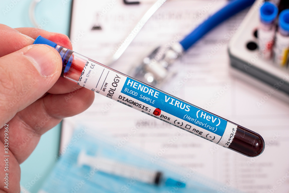 Fototapeta premium Blood samples with infected virus