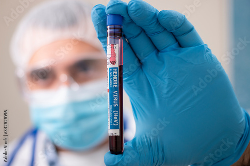 Doctor holding test tube blood sample photo
