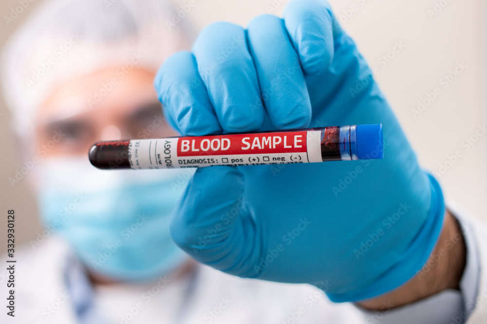 Doctor holding test tube blood sample Doctor holding test tube blood sample