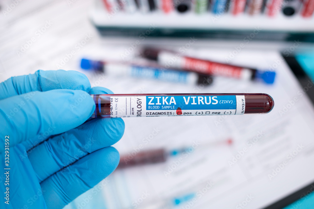 Fototapeta premium Blood samples with infected virus